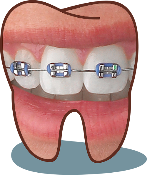 Dental clinic in Kalyani nagar