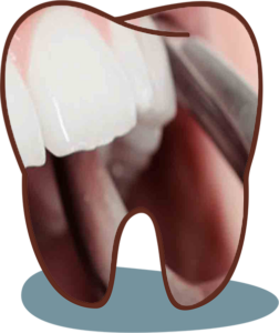 dental clinic in viman nagar