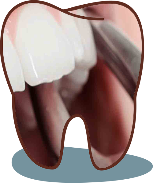 dental clinic in viman nagar