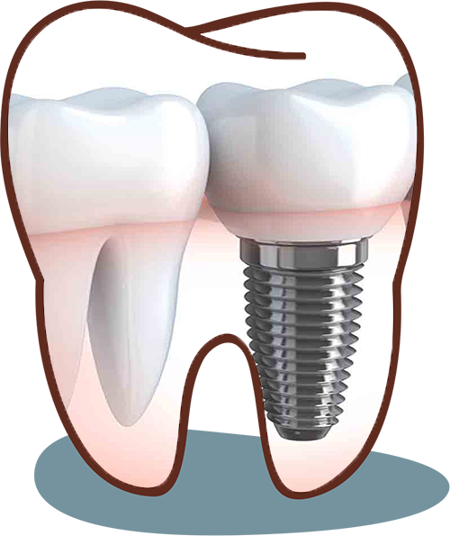 dental clinic in viman nagar