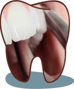 Dr. kakde dental clinic dental clinic in viman nagar