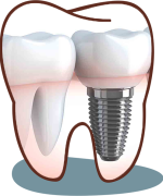 Dr. kakde dental clinic dental clinic in viman nagar